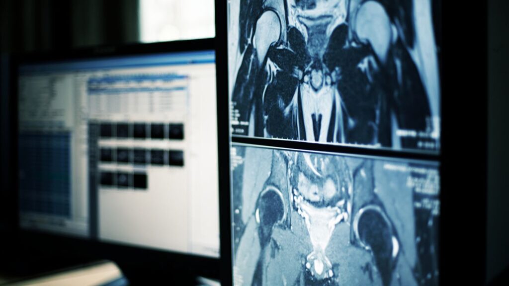 Imagenología en Puebla